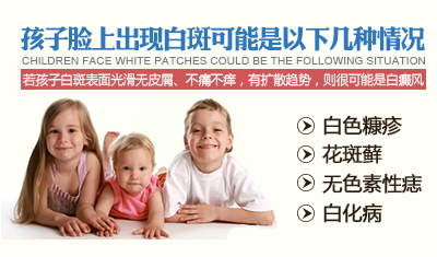 小孩臉上有白斑怎么辦 小孩臉上有白斑怎么辦